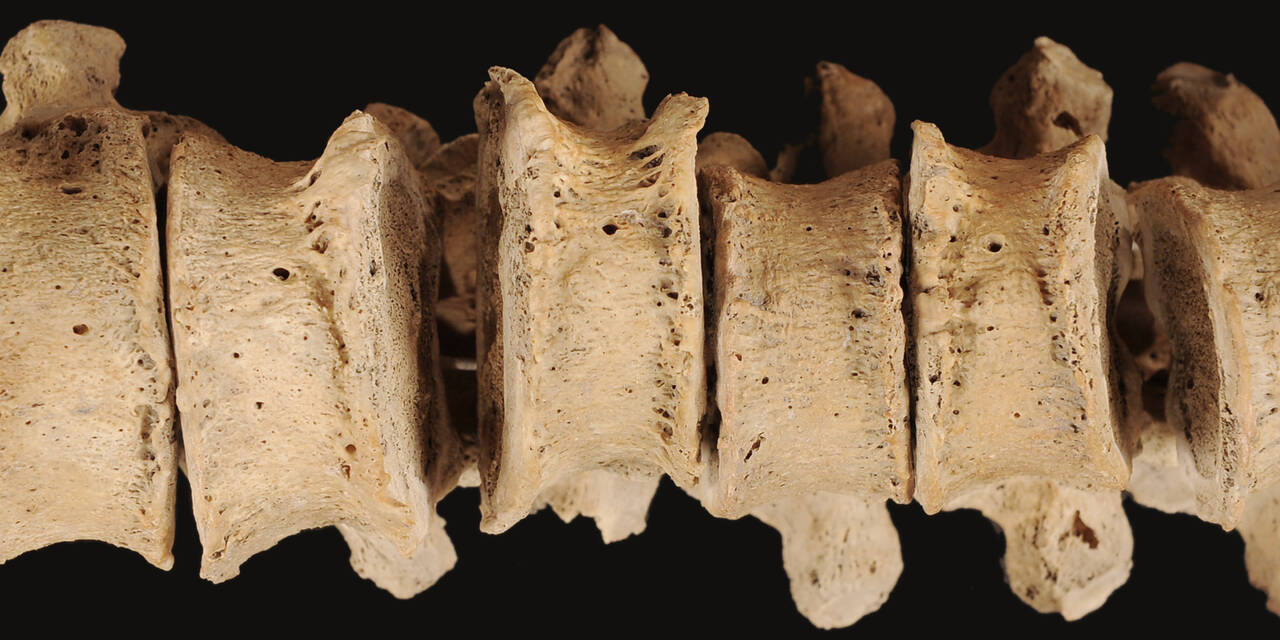 Ausschnitt einer menschlichen Wirbelsäule aus Grabungsfunden in Liechtenstein. | © Amt für Kultur, Abt. Archäologie, Liechtenstein